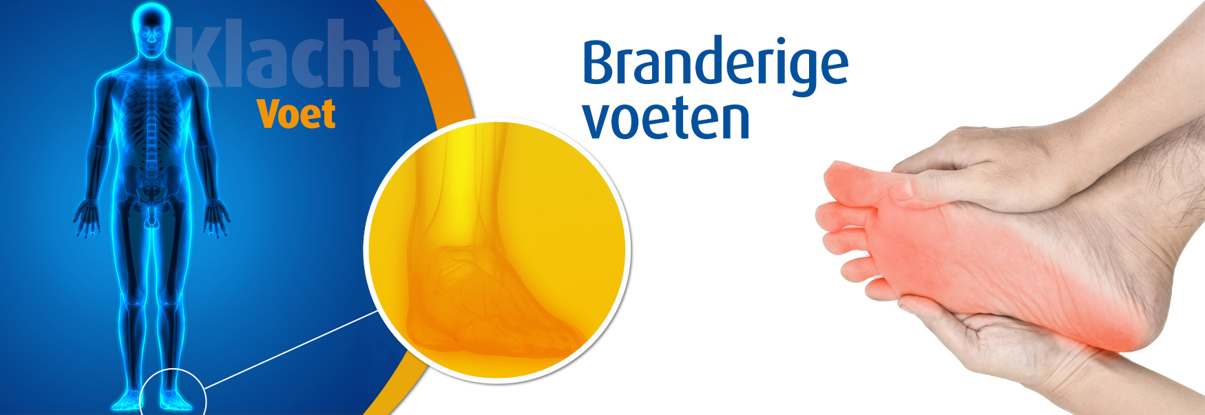 Branderige voeten oorzaken & behandeling Podobrace