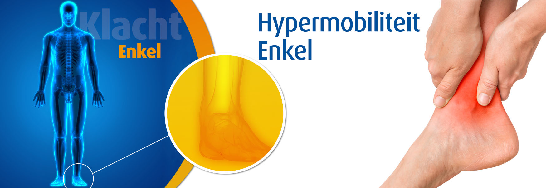 Hypermobiliteit enkel