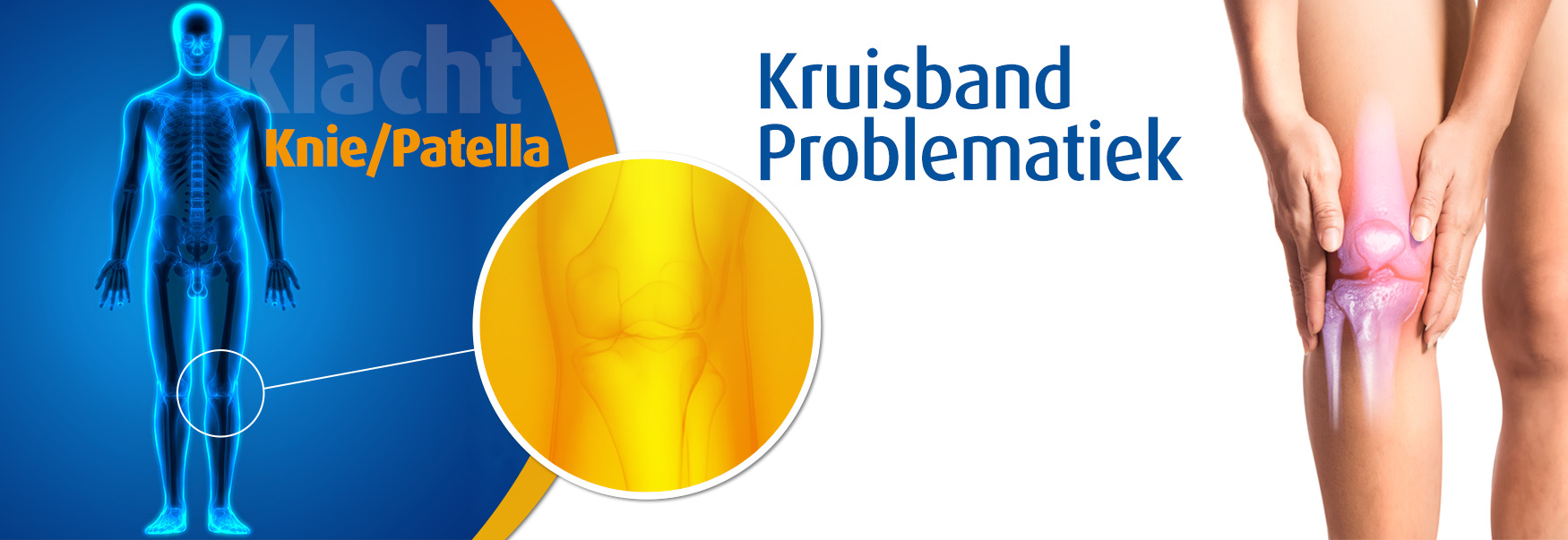 Voorste kruisband kniebrace nodig? Podobrace