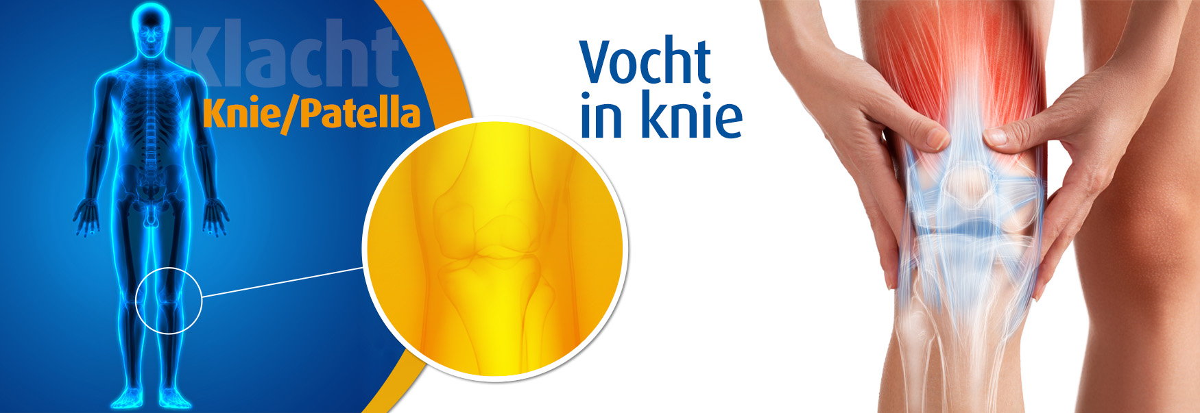 Vocht in de knie Wat is het? Podobrace