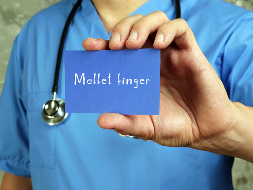 werken met mallet finger
